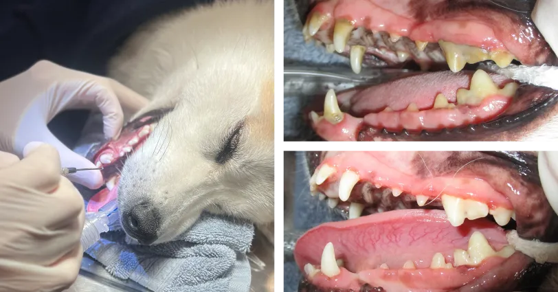 Photos taken before and after periodontal treatment show the results when plaque is removed during a cleaning. 